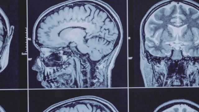 Unlocking the Sixth Sense