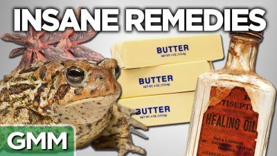 10 Insane Old Time Remedies