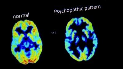 What Makes a Psychopath?